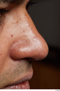 HD Face Skin Henri Sanaky face nose skin pores skin…